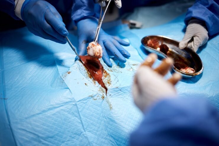 Urological Surgery