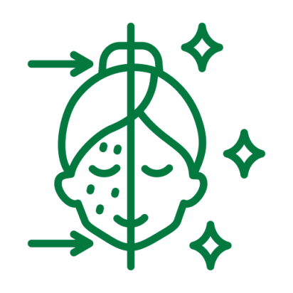 acne-treatment Skin specialist in Chennai