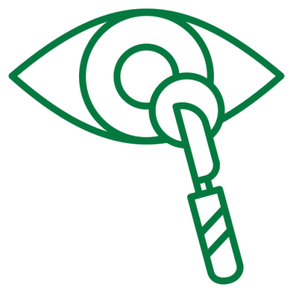 cataract best eye Hospital In chennai