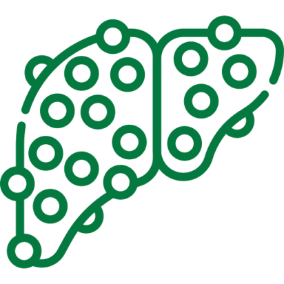 cirrhosis Liver Disease Counselling