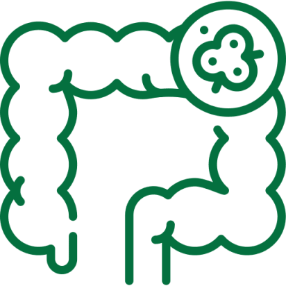 colorectal-cancer general and laparoscopic surgery specialist