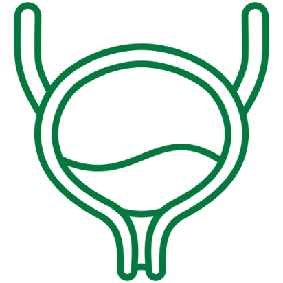 urinary kidney stone treatment in Chennai